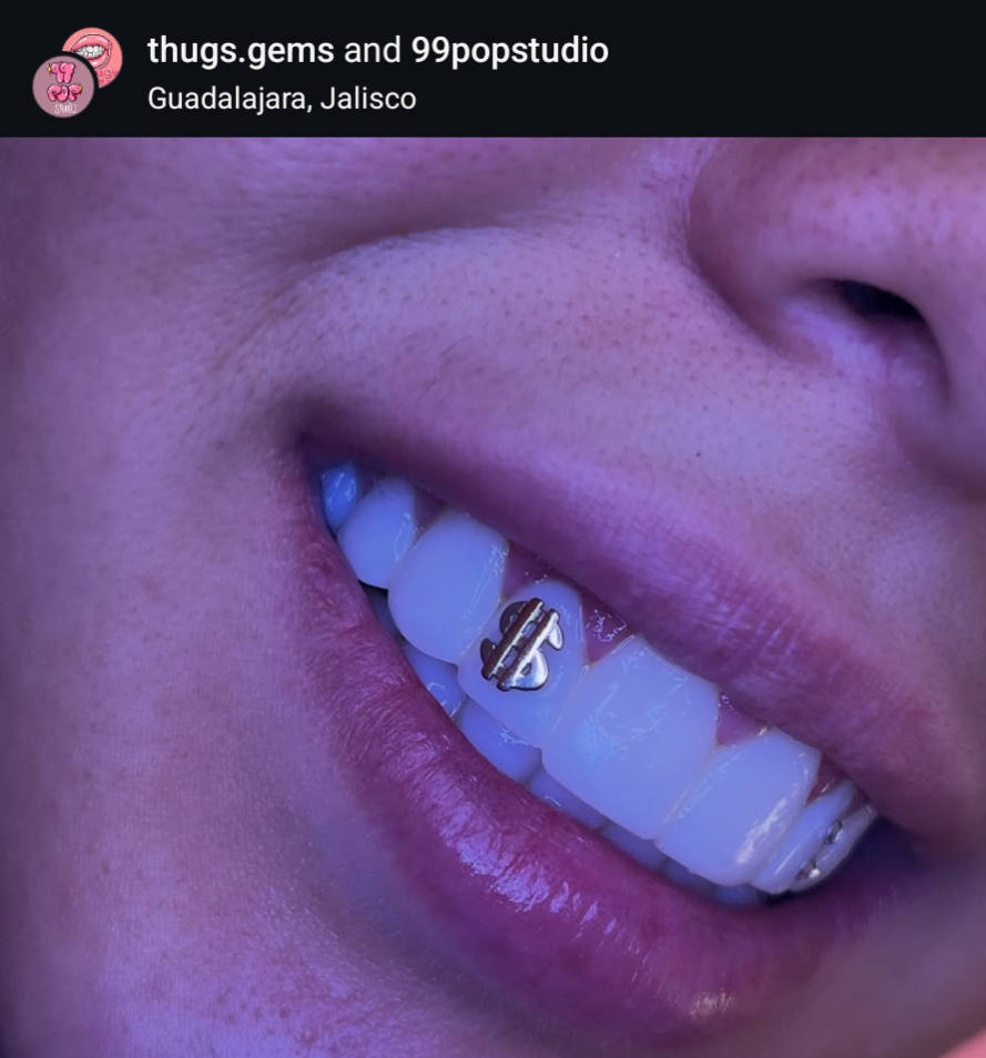 18K Big Money Tooth Gem