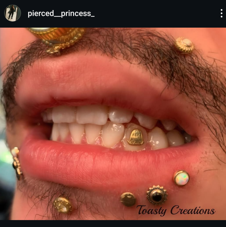 18K Tombstone Tooth Gem
