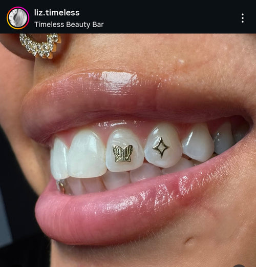 18k Twinkle Doo Tooth Gem