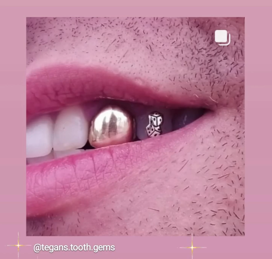 18K Dice Tooth Gem