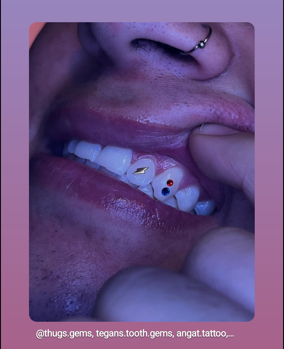 18k Lightning Bolt Tooth Gem
