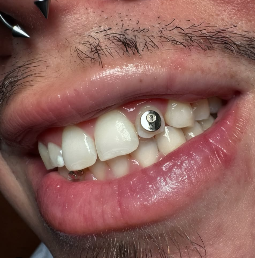 18K 8 Ball Tooth Gem