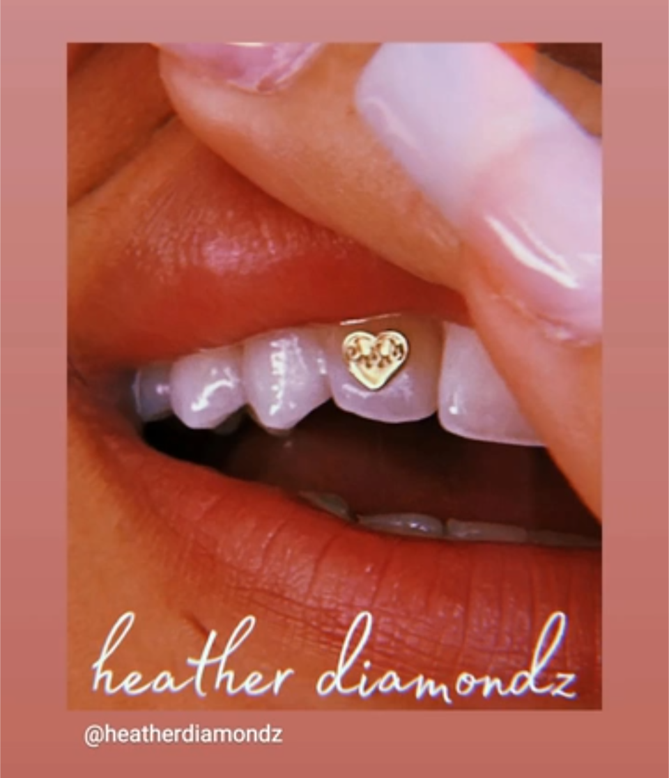 18K Flamed Heart Tooth Gem
