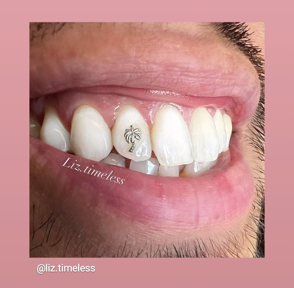 18K Palm Tree Tooth Gem