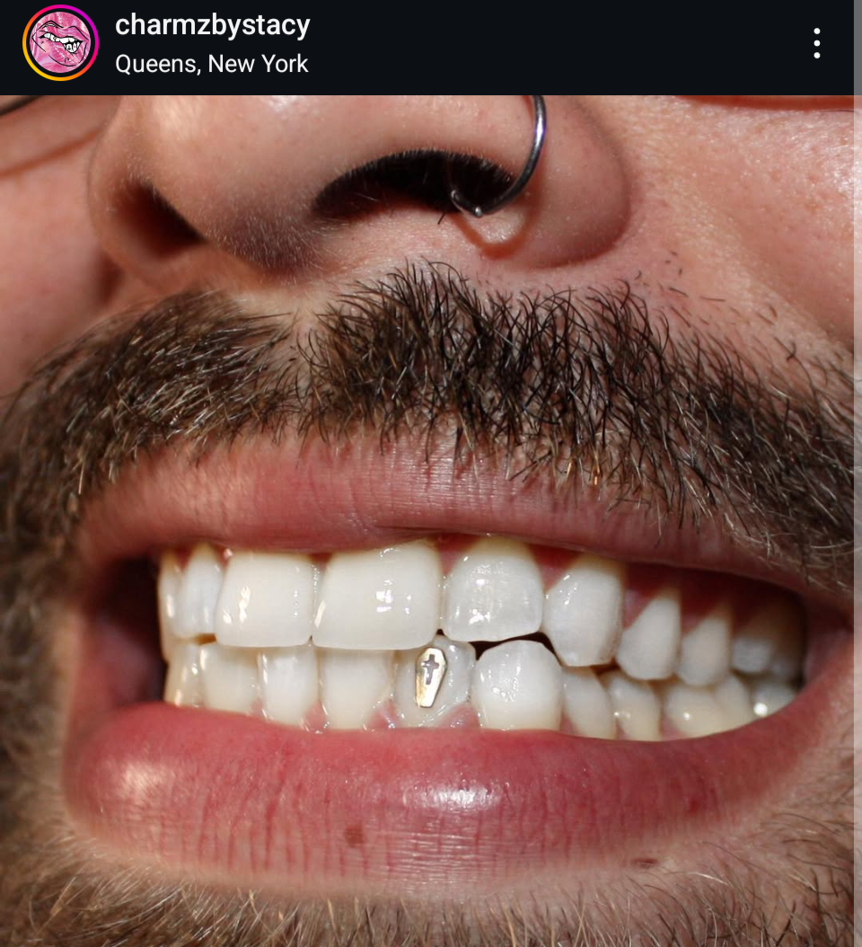 18K Coffin Tooth Gem