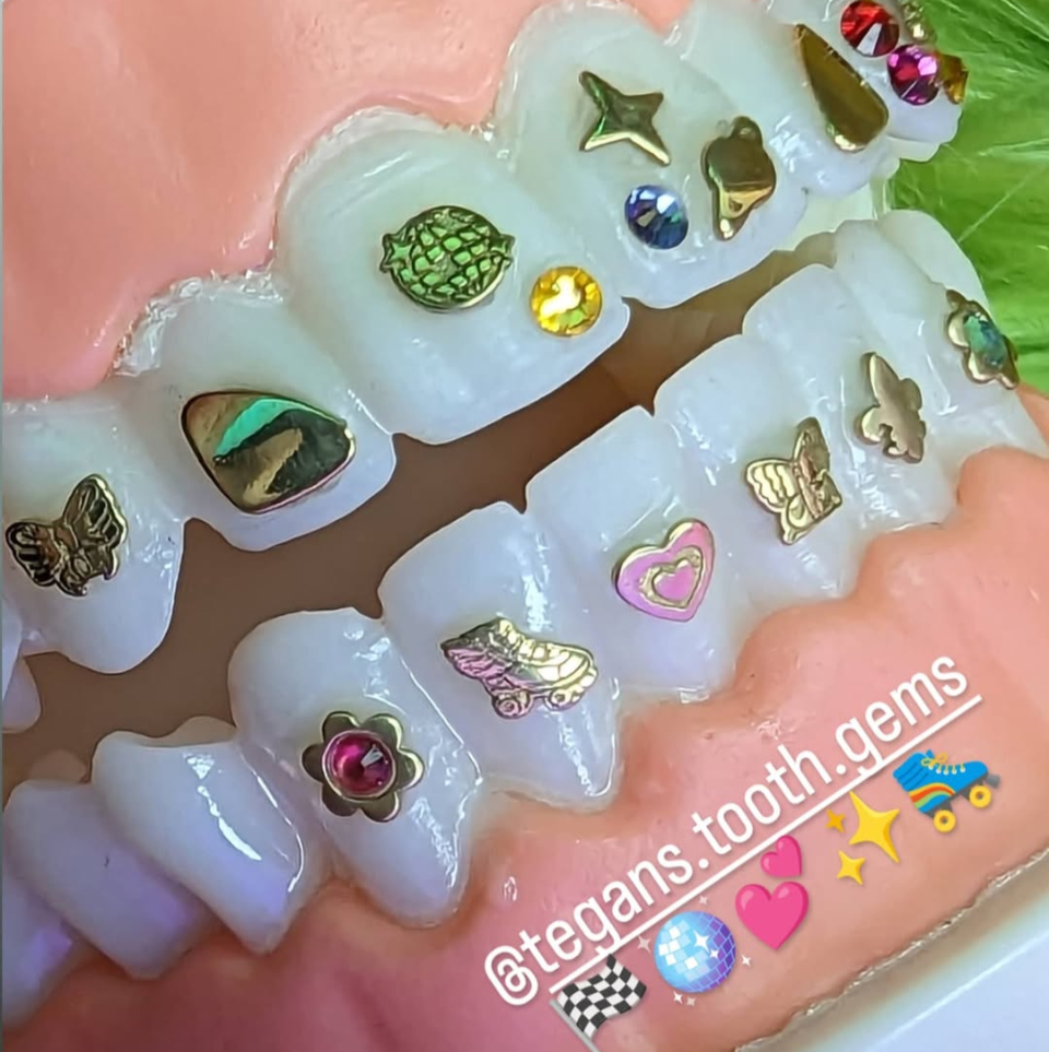 18K Disco Ball Tooth Gem