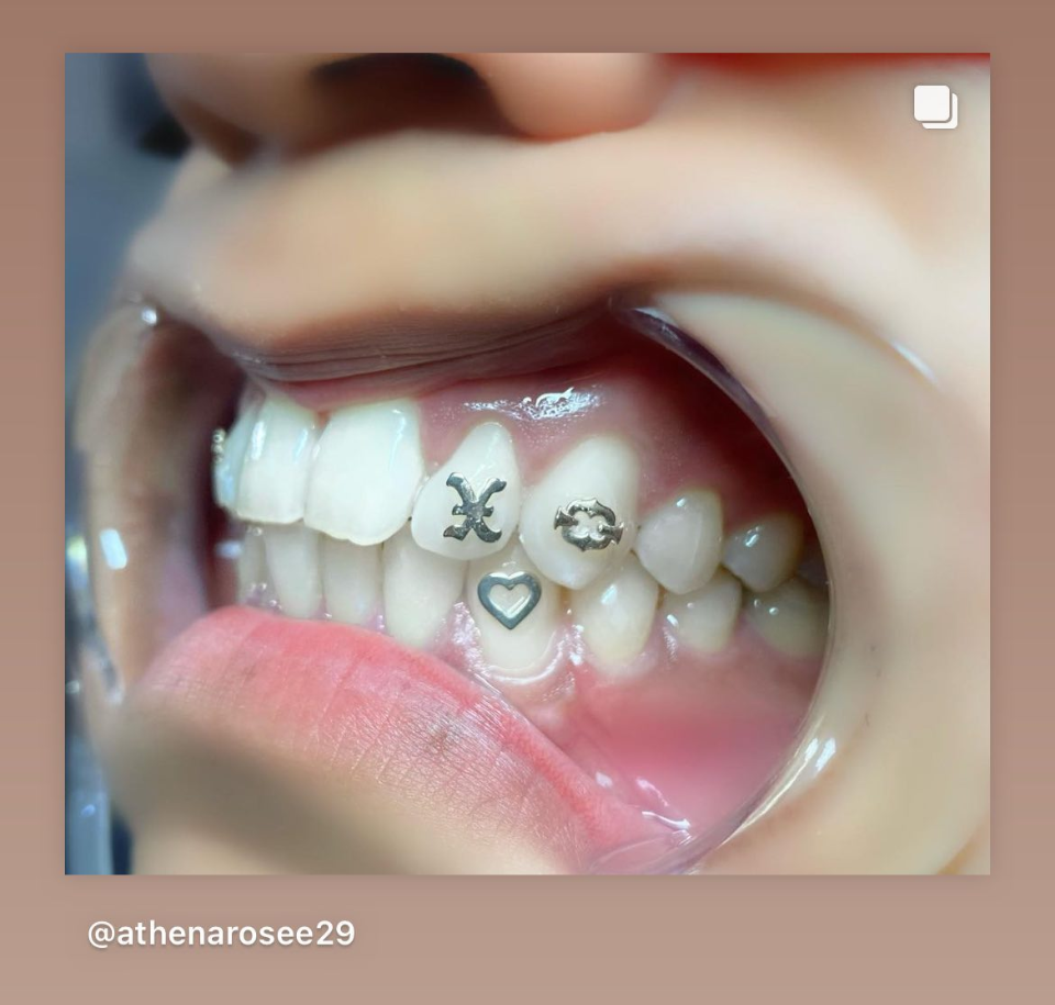 18K Straight Edge X Tooth Gem