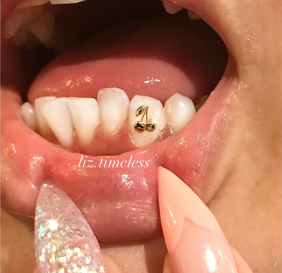 18k Cherries Tooth Gem