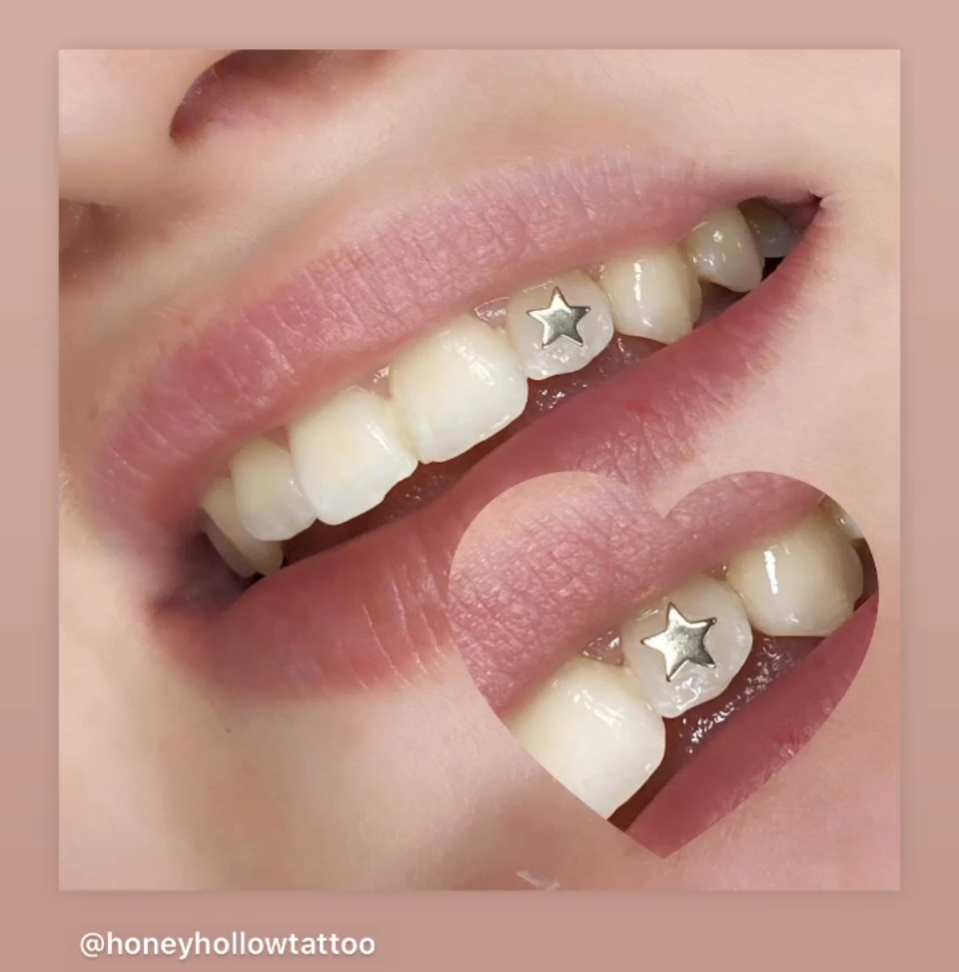 18K Star Tooth Gem