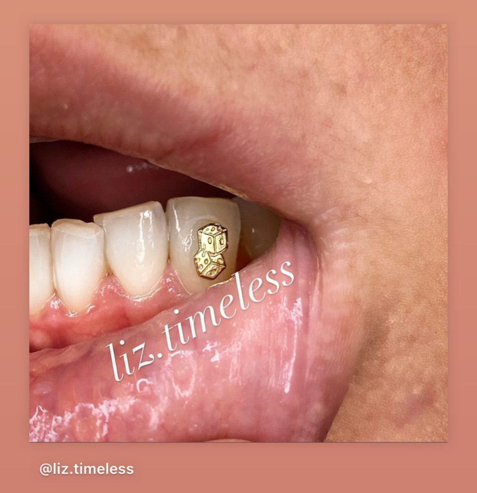 18K Dice Tooth Gem