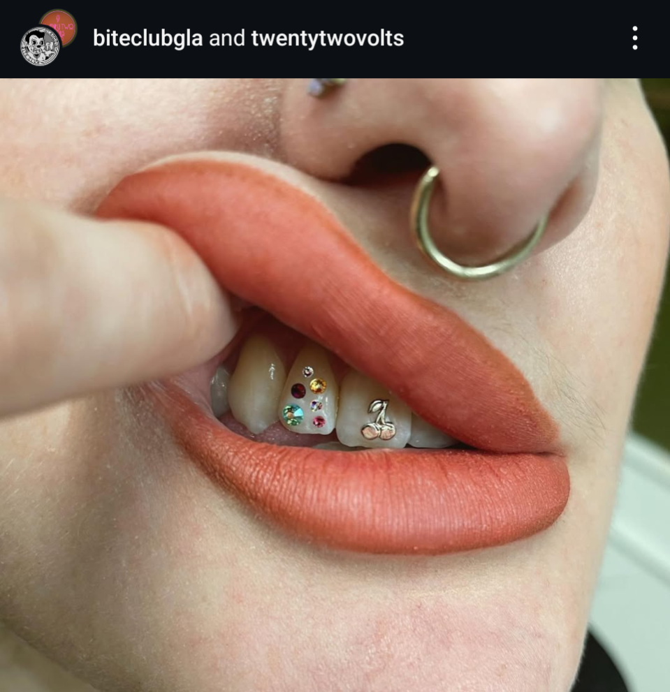 18k Cherries Tooth Gem