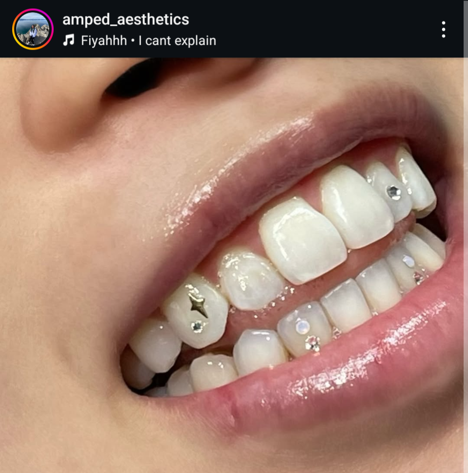 18k Twinkle Dee Tooth Gem