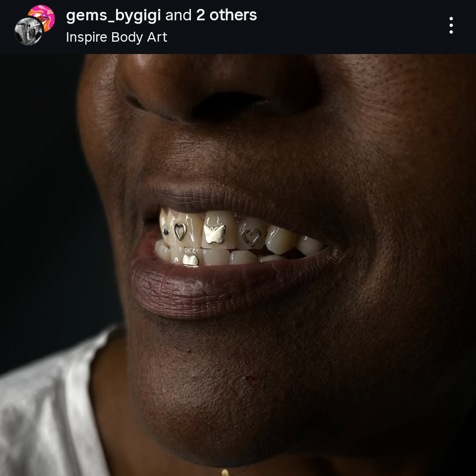 18k Butterfly Tooth Gem