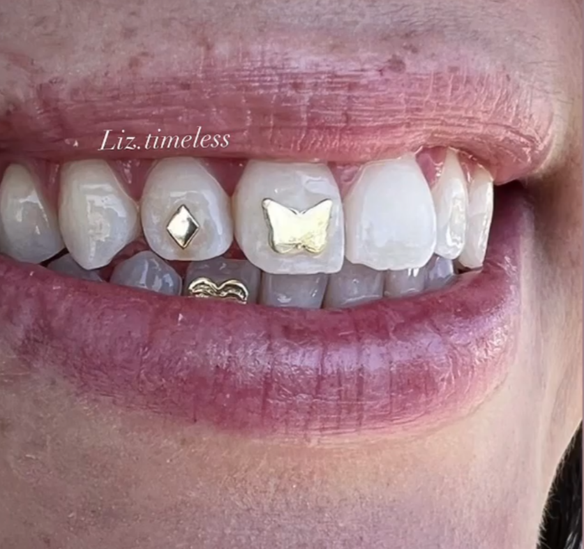 18k Butterfly Tooth Gem